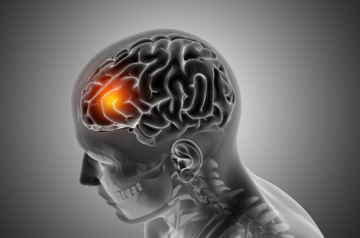 Brain & Spine Tumors