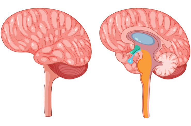 VP Shunting (Hydrocephalus)